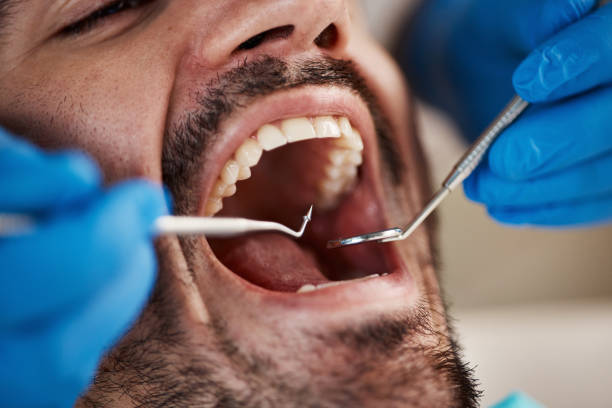 Best Emergency Treatment for Dental Infections or Abscesses in Carefree, AZ